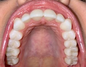 family dentistry Glenview