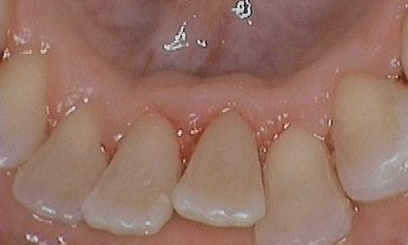 dentist glenview