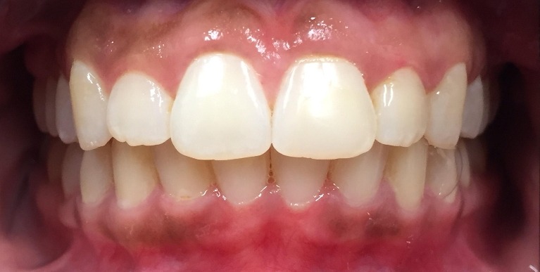cosmetic dentistry glenview