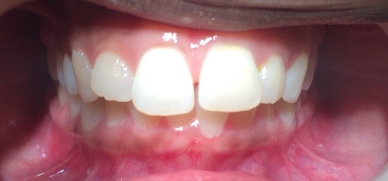 cosmetic dentistry glenview