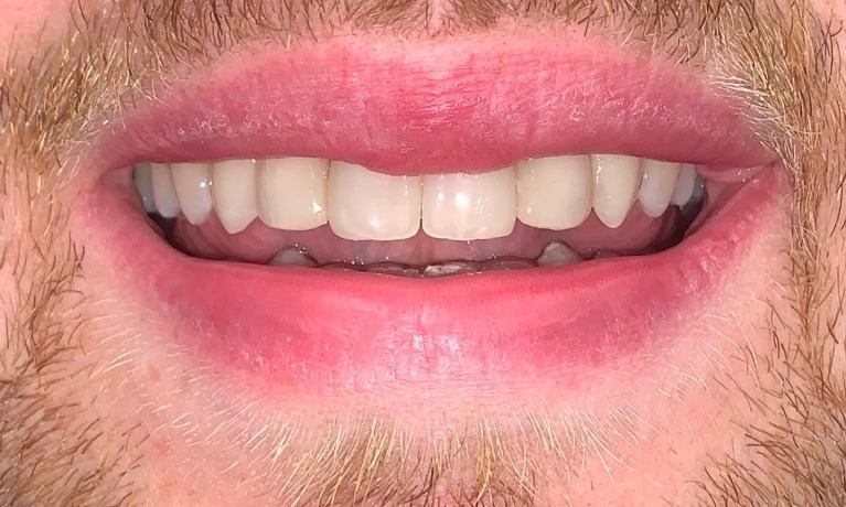cosmetic dentistry glenview