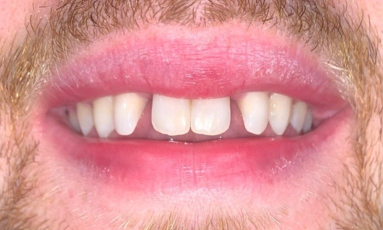 cosmetic dentistry glenview