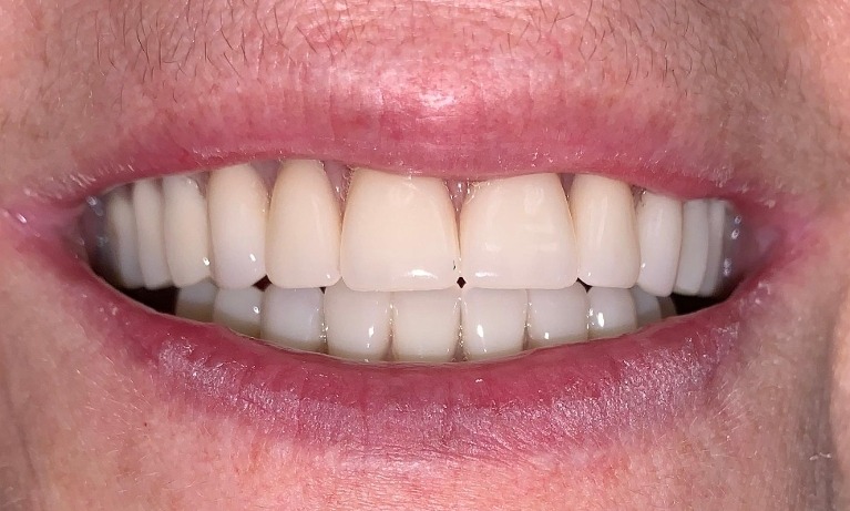 cosmetic dentistry glenview