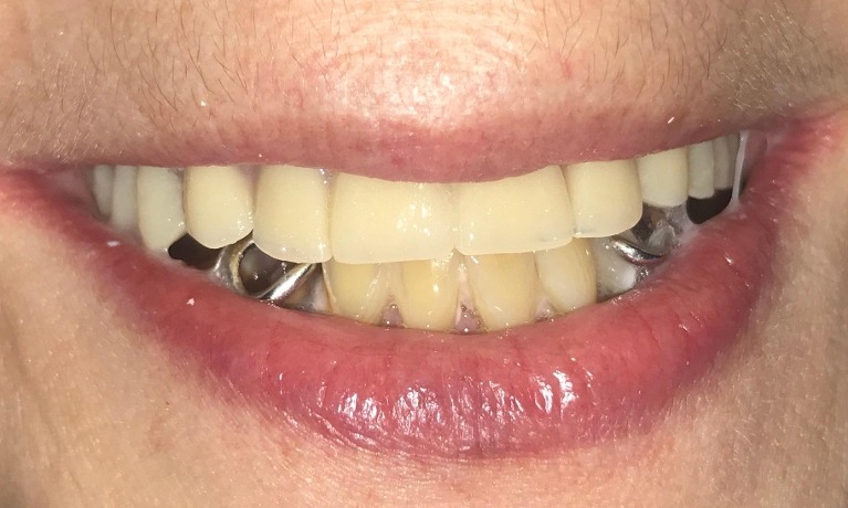 cosmetic dentistry glenview