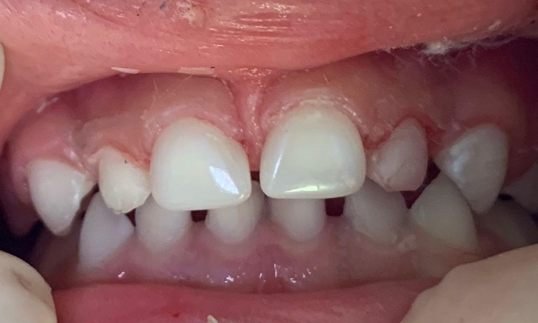 cosmetic dentistry glenview
