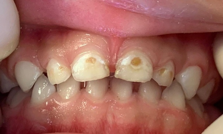cosmetic dentistry glenview