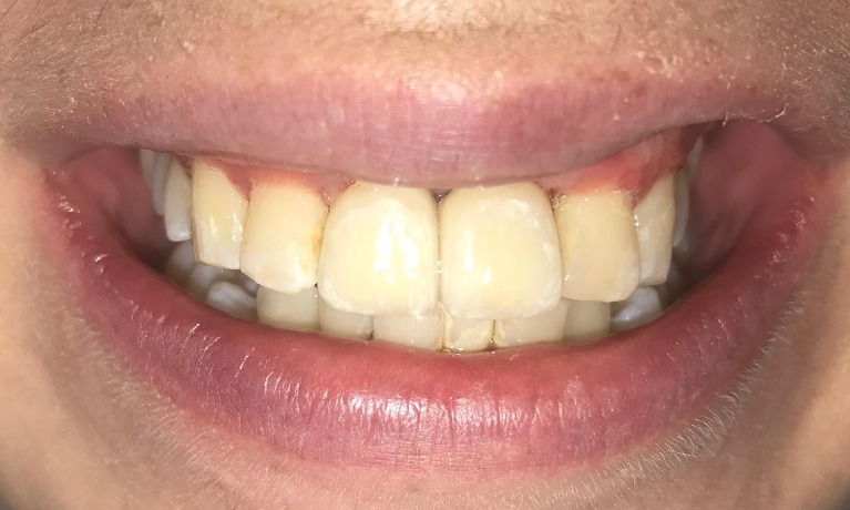 cosmetic dentistry glenview