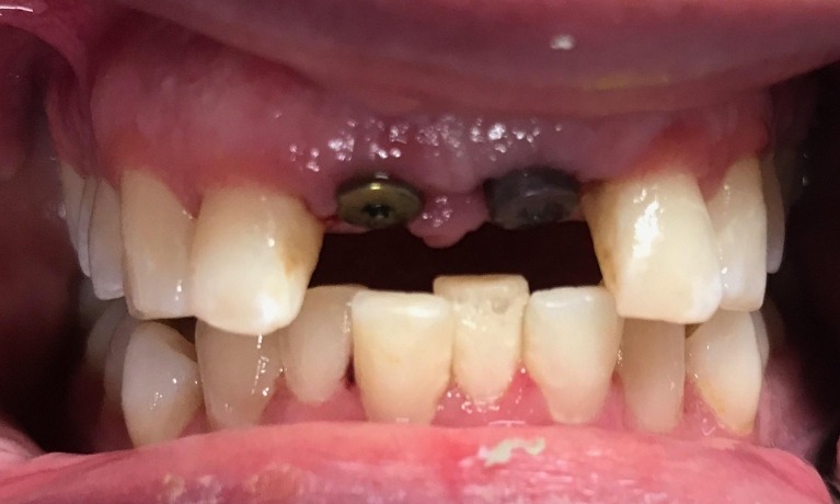 cosmetic dentistry glenview