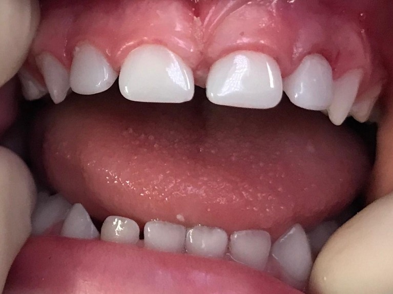 dental implants glenview