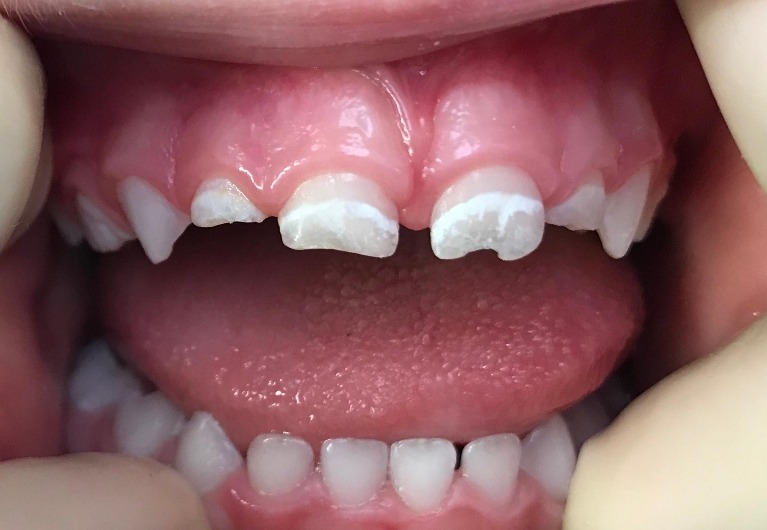 dental implants glenview