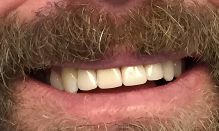 dental implants glenview