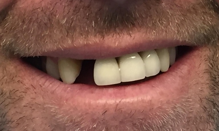 dental implants glenview