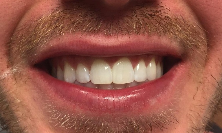 dental implants glenview
