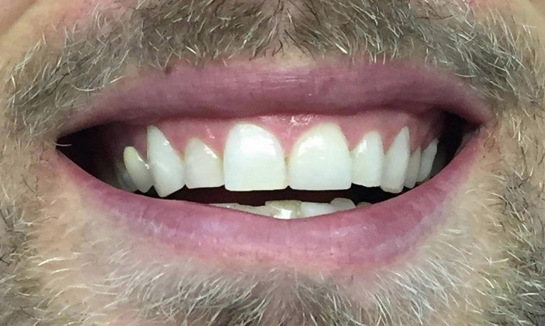 dental implants glenview