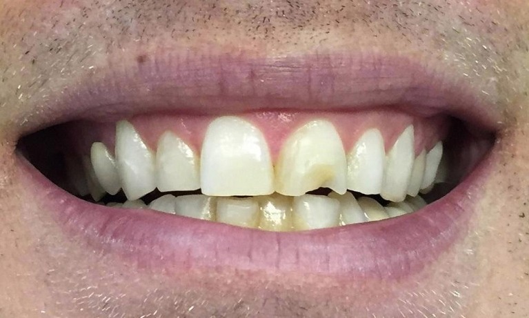 dental implants glenview