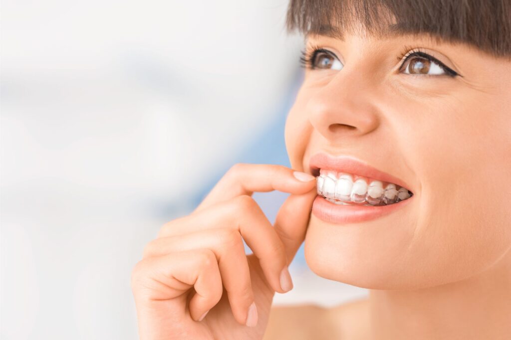 glenview cosmetic dentistry - Invisalign Clear Aligners