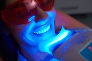 glenview cosmetic dentistry - Teeth whitening