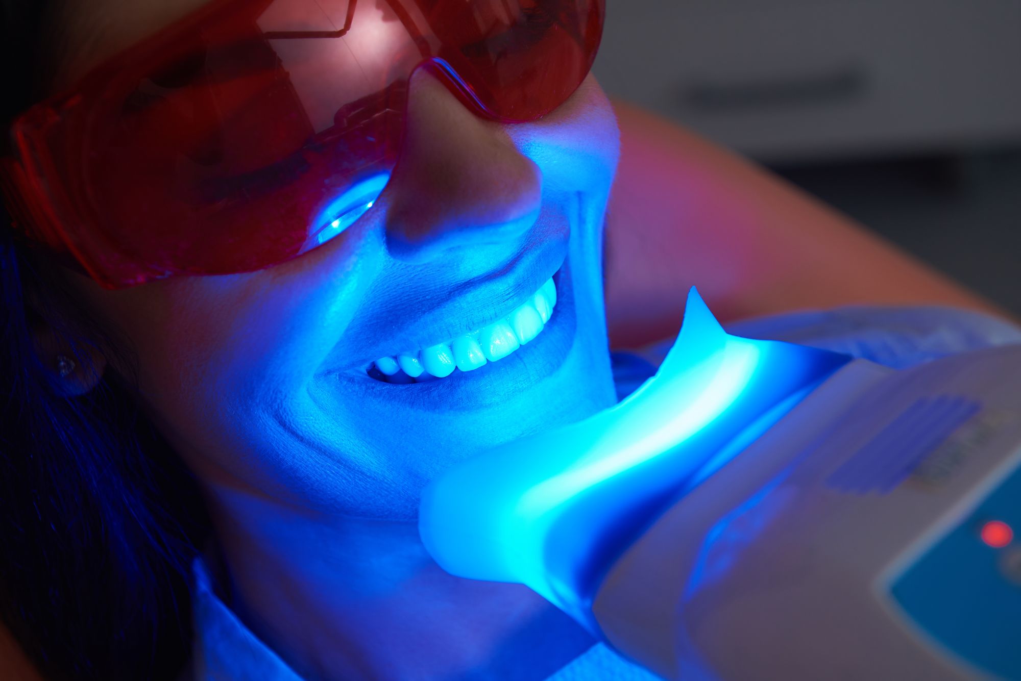 glenview cosmetic dentistry - Teeth whitening